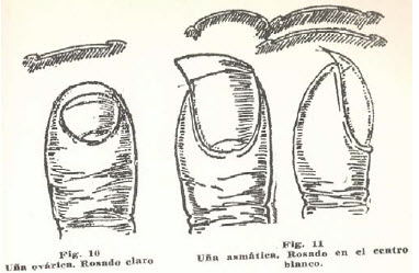 2-una-ovarica