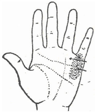 57-lesiones-del-brazo