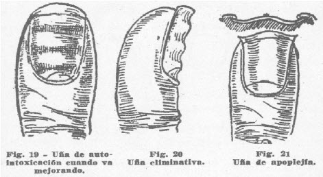 7-una-autointoxicacion