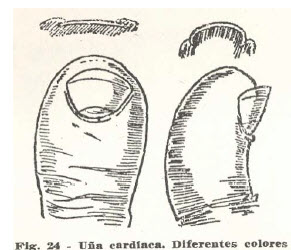 9-una-cardiaca